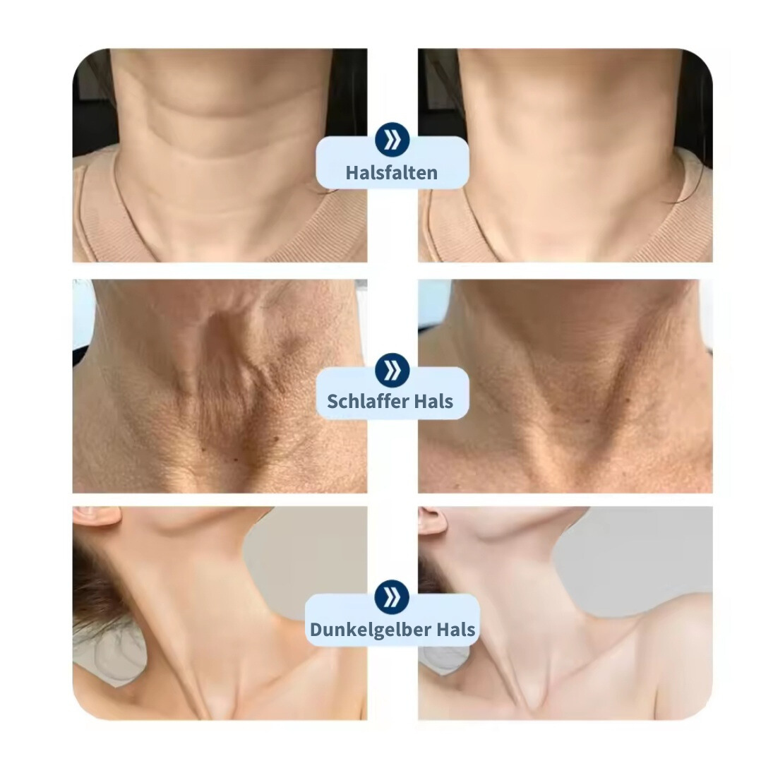 Skin Booster